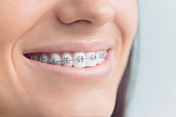 TMJ/TMD Treatment in Belleville, IL
